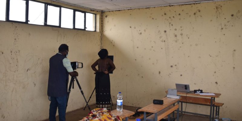 Dans le cadre du projet REACH Ethiopia, une patiente consulter pour suspicion d'avoir contractée la tuberculose